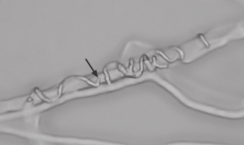 Mycoparasitic coiling of Trichoderma atroviride around Botrytis cinerea hyphae. Arrow indicates site of penetration. 